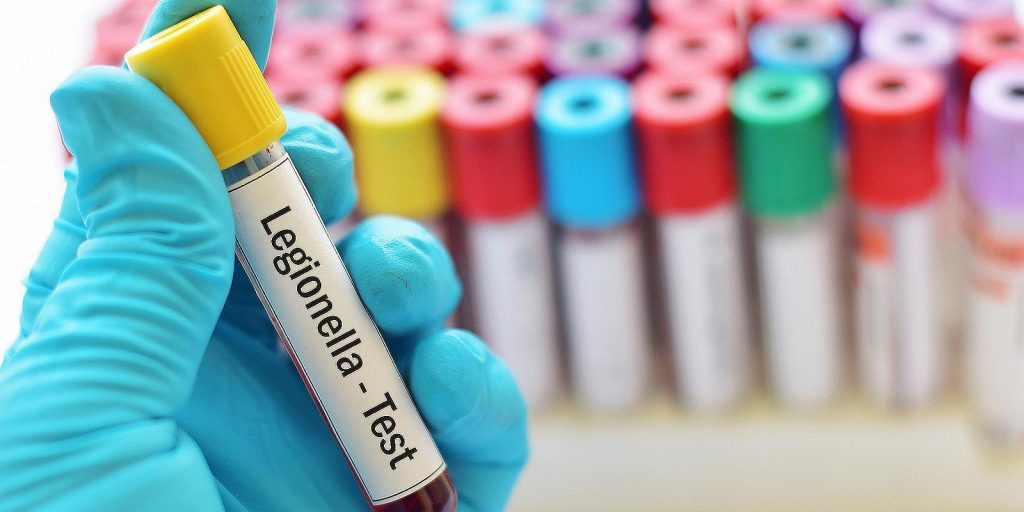 UPC legionella test